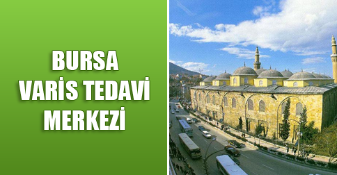 bursa-varis-tedavi-merkezi