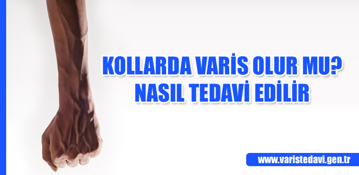 kollarda varis olur mu