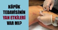 köpük tedavisinin yan etkileri