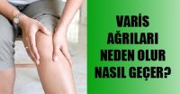 varis ağrıları