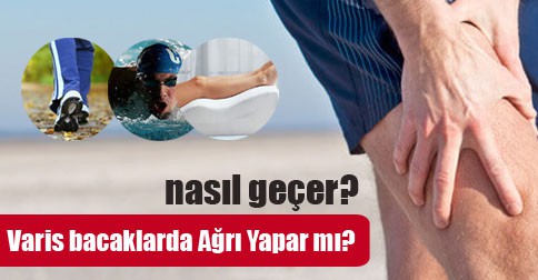 varis ağrı yapar mı