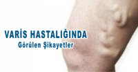 varis şikayetleri nelerdir