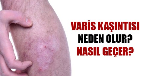 varis-kasintisi