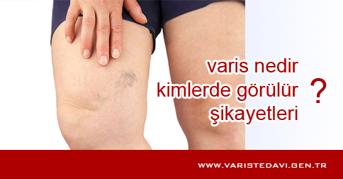 varis-nedir