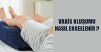 varis oluşumu nasıl engellenir